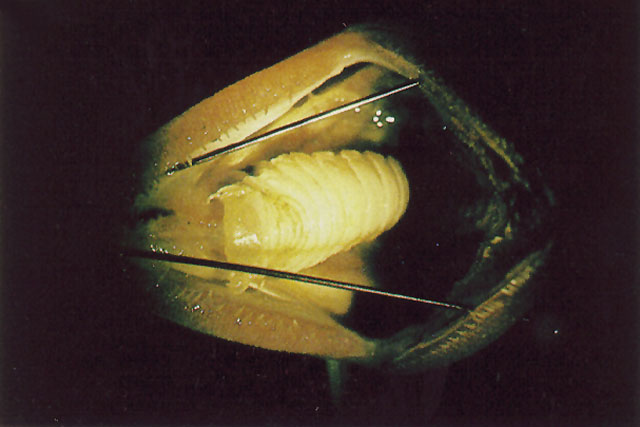 (Sardinella fimbriata) 7f Isopoda infestation with Aega disease